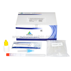 HIV antibody rapid test kit