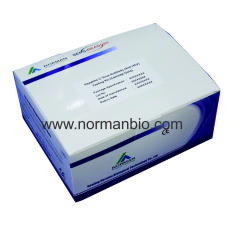 Hepatitis C Virus Antibody(Anti-HCV)Testing Kit