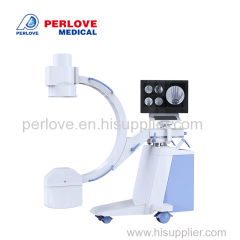 Medical Imaging Fluoroscopy X ray Equipment Mobile Medical Diagnostic X-ray Equipment