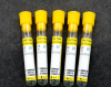 Gel tube non- vacuum blood collection tube