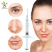 Bouliga Cross Linked Ha Injectable Dermal Filler Injection