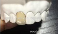 HUILE DENTURE TECHNOLOGY (HONGKONG) CO., LIMITED