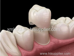 Dental Zirconia Crown Cercon Dental Teeth Laboratoire Dentaire Dentallabor China Dental Lab