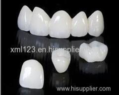 Dental lab Zirconia porcelain denture China Dental Laboratory