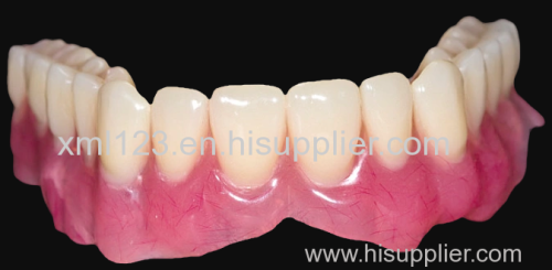 Denture Steel Partial Flexible Removable Teeth 