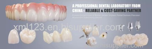 China dental lab denture Dental lab China Dental lab Dental lab
