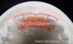 Dental Products Dental Products Teeth Porcelain Laboratory False Fixed Denture Plates Dental Crowns For Dental Clinic