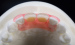 Inlays Onlays Ceramic Dental Crown Strong Veneer For Dental Department