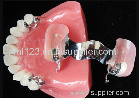 Denture Steel Partial Flexible Removable Teeth 