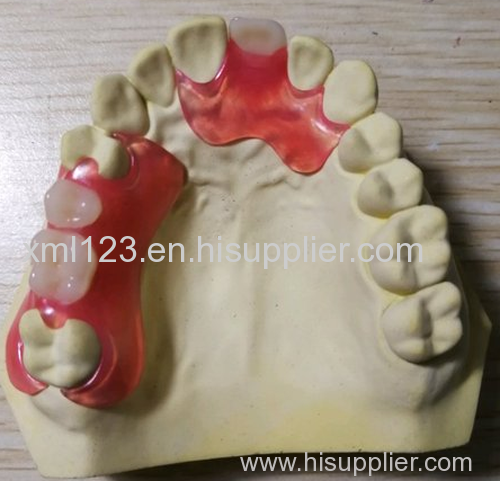 High Translucent Zirconia Dental Crown