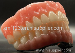 3d Printing Porcelain False Teeth Dental 3d Print