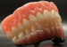 3d Printing Porcelain False Teeth Dental 3d Print