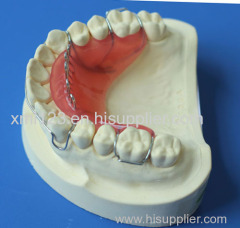 Dental Pfm Crown From China Dental Lab