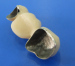 Dental lab Zirconia porcelain denture