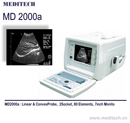7 inch diagnostic Portable Ultrasound Scanner