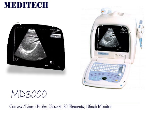 diagnostic Portable B/W Ultrasound Scanner