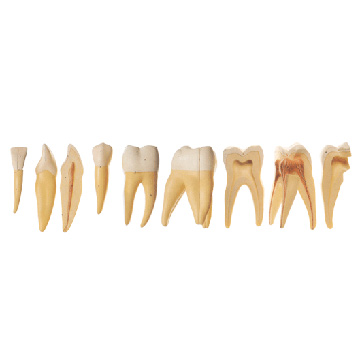 Five Models of Teeth