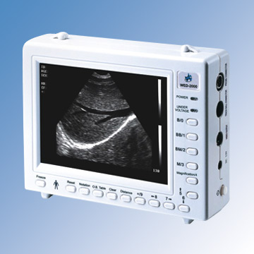 Palmtop B-Mode Ultrasound Mechanical Sector Scanners