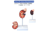 Kidney with Adrenal Gland 