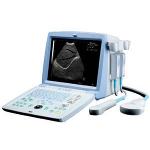 Ultrasound Diagnostic Device