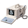 Ultrasound Diagnostic Device