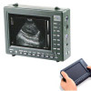 PalmTop Ultrasound Scanner