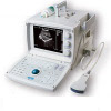 Portable Ultrasound Scanner