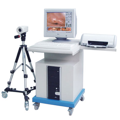 Digital Colposcope