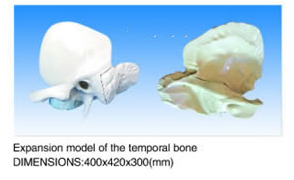 Expansion Model of The Temporal Bone