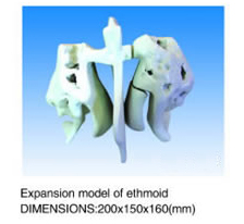 Expansion Model of Ethmoid