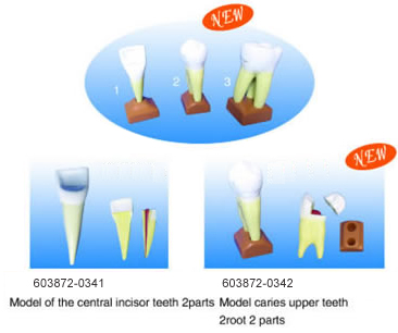 Model of the Central Incisor Teeth 2parts, Model Caries Upper Teeth 2root 2 parts