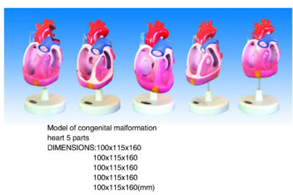 Model Of Congenital Malformation Heart 5 Parts