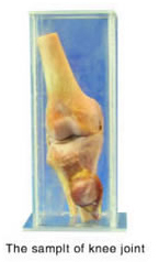 The Sample of Knee Joint