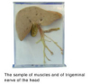 The Sample Of Muscles And Of Trigeminal Nerve Of The Head