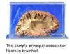 The Sample Principal Association Fibers In Brain Half