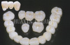 ceramic teech(tooth)