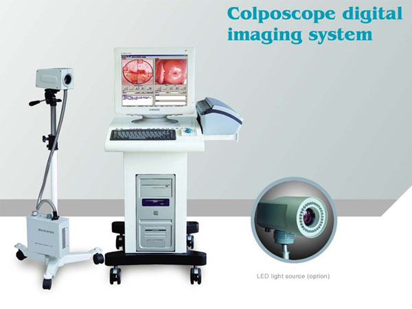 Colposcope Digital Imaging System