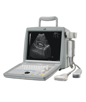 Portable Veterinary Ultrasound Diagnostic Device