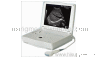 15 Digital Laptop Ultrasound Scanner