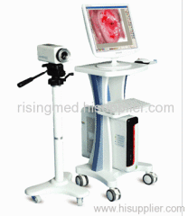 Electronic Colposcope