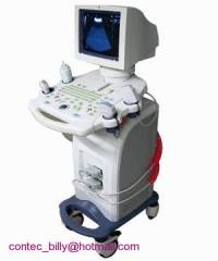 Mobile Ultrasound Machine---Medical ultrasound scanner
