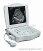 Full Digital Laptop Ultrasound Scanner