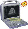 Portable ultrasound