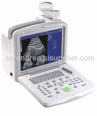 Portable Ultrasound Scanner