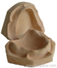 plaster model of edentulous jaw