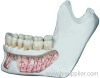 Natrual-sized Mandible Model