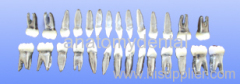 permanent teeth metal root resin crown