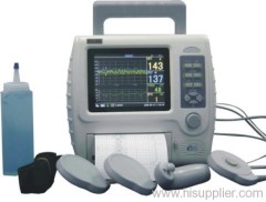 Fetal Monitor