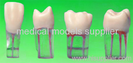 root canal model S12