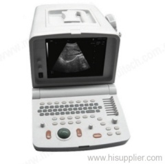 Ultrasound Scanner